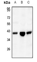 IDH3 alpha Rabbit Polyclonal Antibody