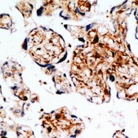 IGF1 Antibody