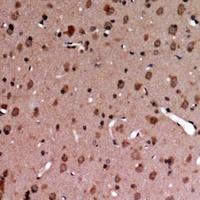 Anti-MERTK/TYRO3 (Phospho-Y749/681) Antibody