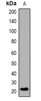 GEF2 Rabbit Polyclonal Antibody