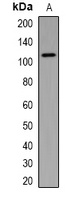 TSC1 Antibody