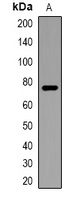 ACSS1 Antibody