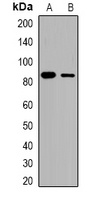 Beta-catenin Rabbit Polyclonal Antibody