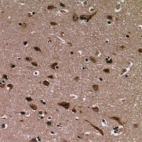 Anti-Annexin A1 Antibody