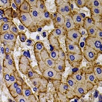 CCR5 antibody