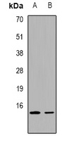 FABP2 Antibody