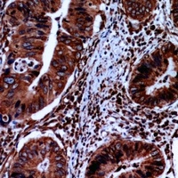 FABP2 Antibody