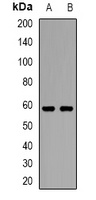 ASIC1 Antibody