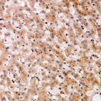 Anti-SOCS2 Antibody