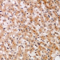 SOCS2 antibody