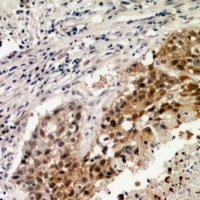 FLT4 antibody