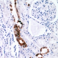 EGF antibody