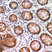 Anti-CDK6 Antibody