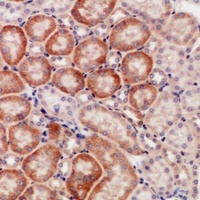 Anti-CD168 Antibody
