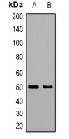 GAT1 Rabbit Polyclonal Antibody