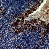 Anti-CD21 Antibody
