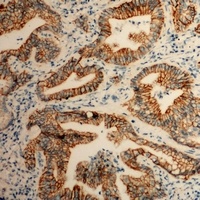 ITGA2 antibody