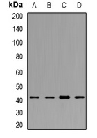 CD64 Rabbit Polyclonal Antibody
