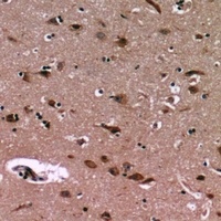 CD64 Rabbit Polyclonal Antibody