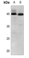 CD273 Rabbit Polyclonal Antibody
