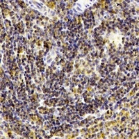Anti-CD238 Antibody