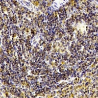 KEL antibody