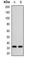 CD305 Rabbit Polyclonal Antibody