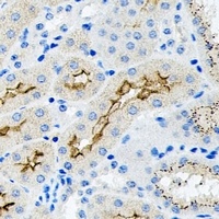 Anti-TGF beta 2 Antibody