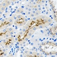 TGFB2 antibody