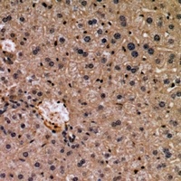 Anti-WISP3 Antibody