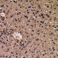 WISP3 antibody