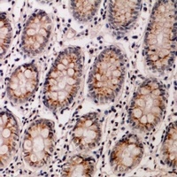 Anti-IL-12B Antibody