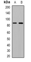 Beta Amyloid Antibody
