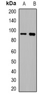 Villin Rabbit Polyclonal Antibody
