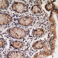 Villin Rabbit Polyclonal Antibody
