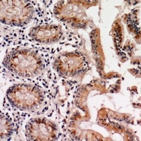 PTEN Rabbit Polyclonal Antibody