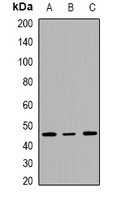 INI1 Rabbit Polyclonal Antibody
