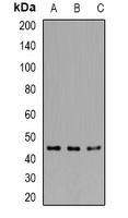 RCC1 Rabbit Polyclonal Antibody