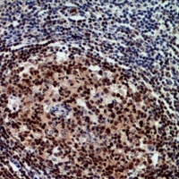 Anti-RCC1 Antibody