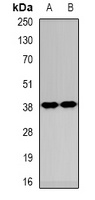 CK1 alpha Rabbit Polyclonal Antibody