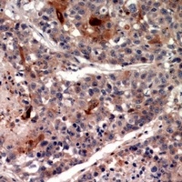 CK1 alpha Rabbit Polyclonal Antibody