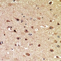 Anti-MIB1 Antibody