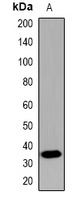 CDX2 Rabbit Polyclonal Antibody