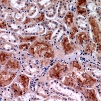 Rel antibody