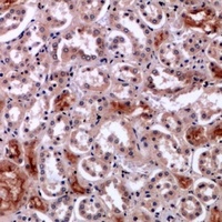 Anti-Perforin 1 Antibody