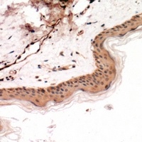 Cytokeratin 14/17 Antibody