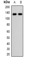 RET Rabbit Polyclonal Antibody