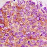 RET Rabbit Polyclonal Antibody
