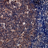 Anti-Tryptase delta Antibody