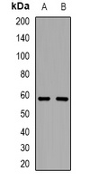 Tyrosyl-tRNA Synthetase Rabbit Polyclonal Antibody